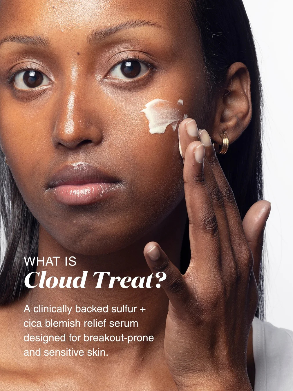 Cloud Treat 5% Sulfur Blemish-Soothing Serum NEW IN!