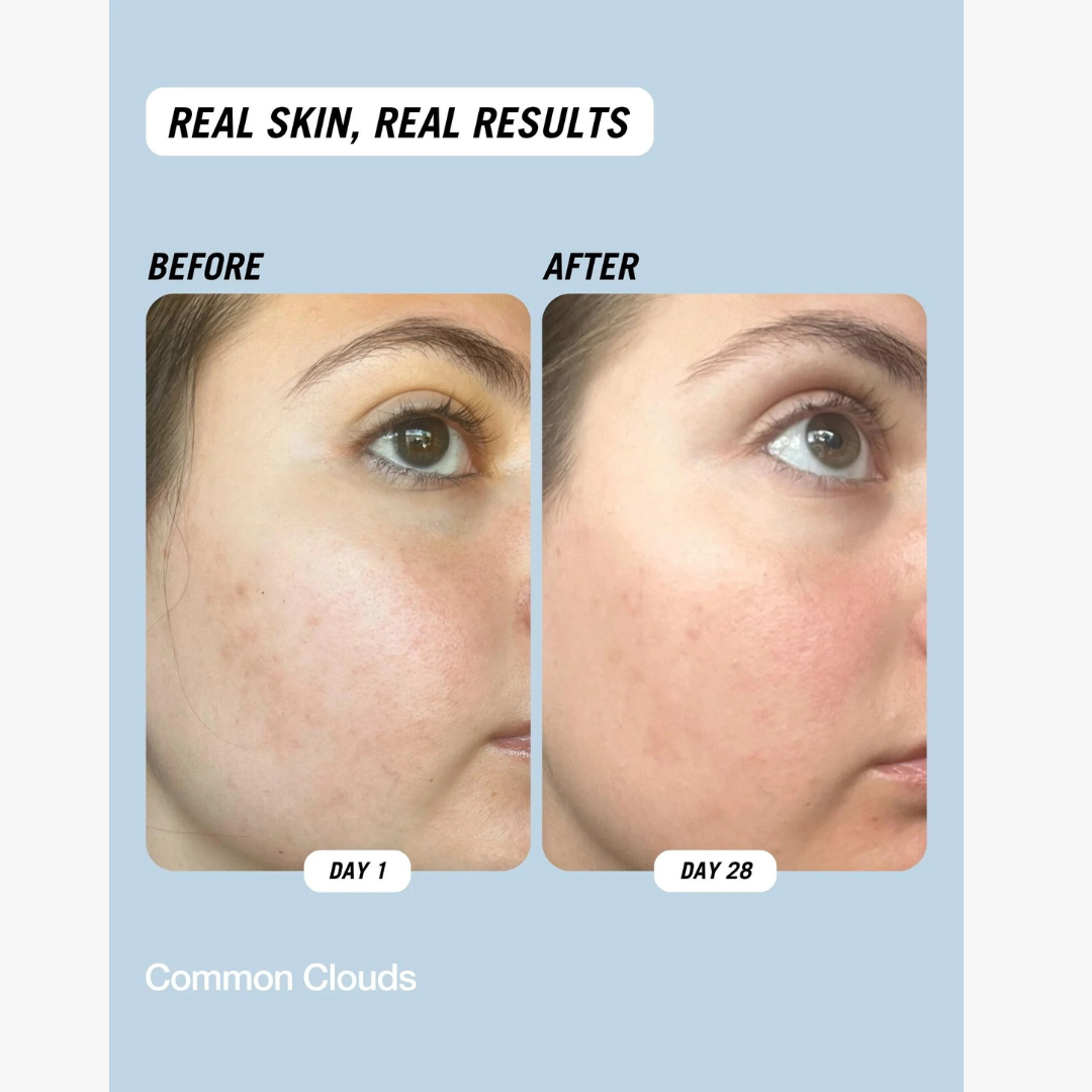 Cloud Water Gentle Exfoliating Toner