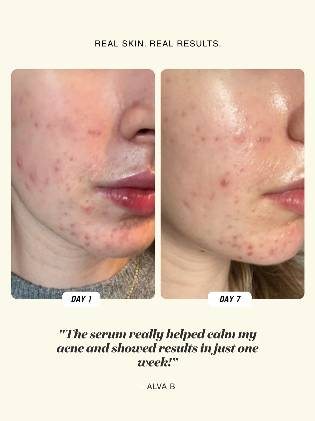 Cloud Treat 5% Sulfur Blemish-Soothing Serum NEW IN!