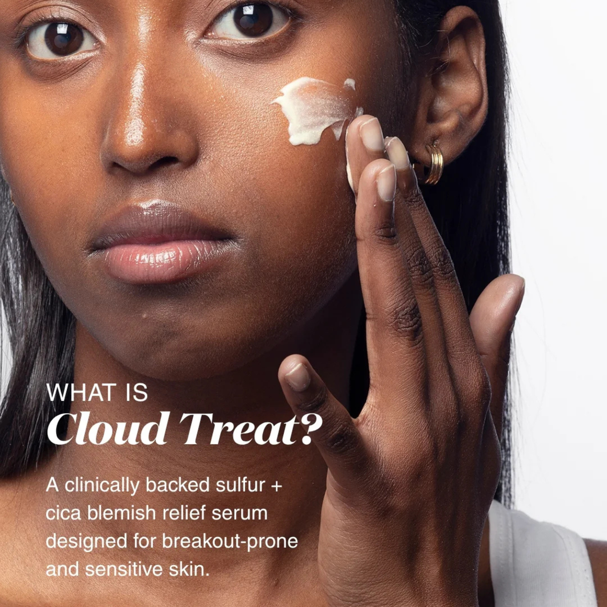 Cloud Treat 5% Sulfur Blemish-Soothing Serum NEW IN!