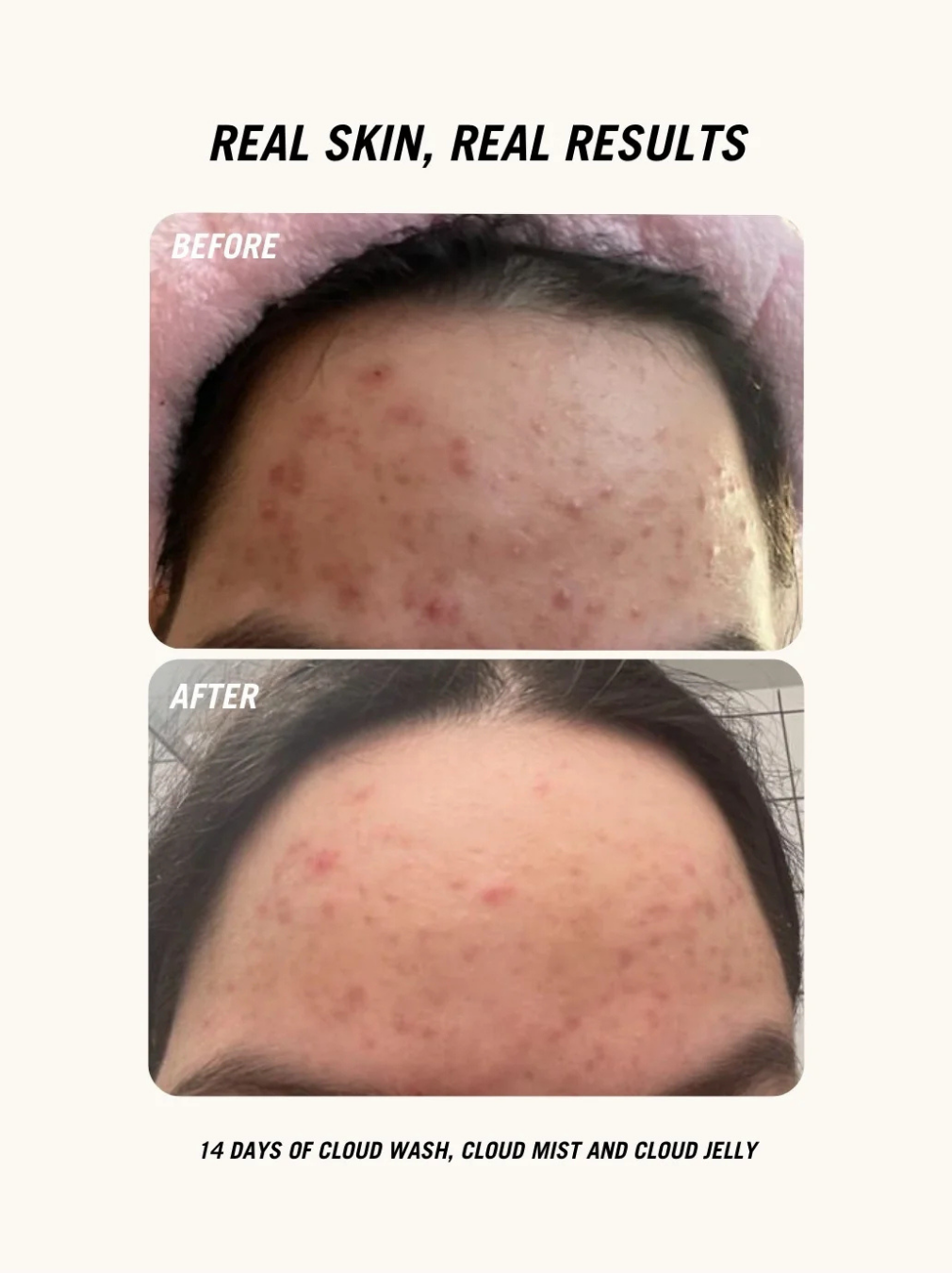 Cloud Jelly - Everyday Cica Gel Moisturiser