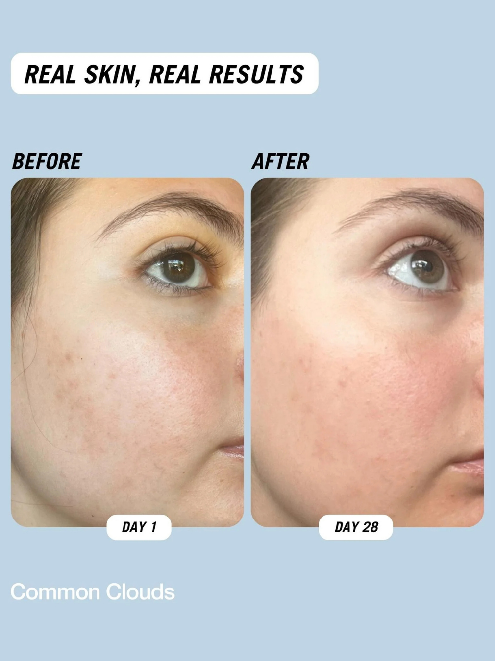 Cloud Water Gentle Exfoliating Toner
