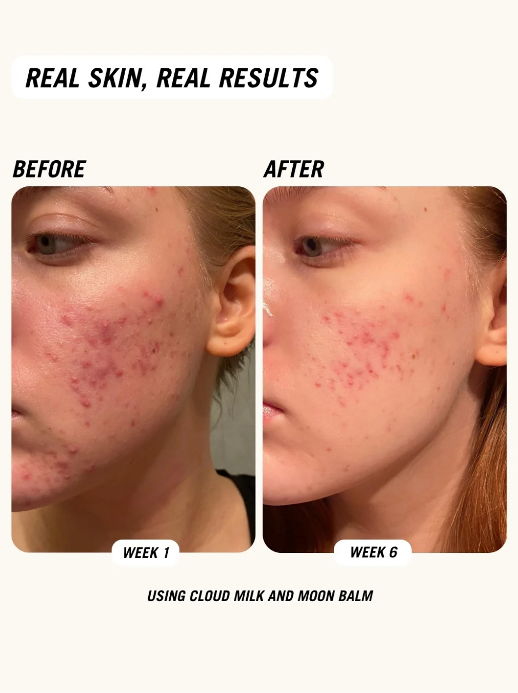 Cloud Milk Serum