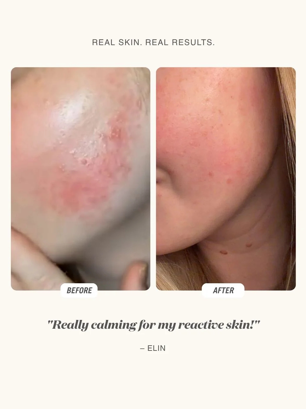 Cloud Mist SOS Recovery Spray