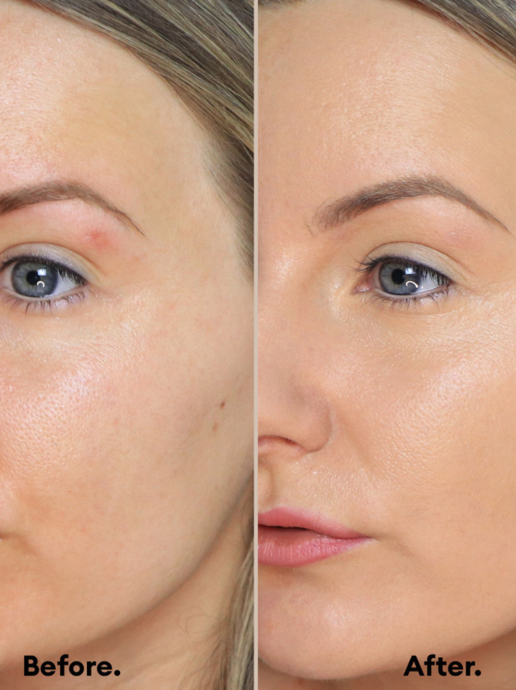 Uniset® Lightweight Foundation